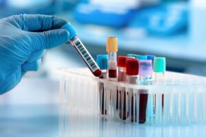 glicemia emoglobina glicata insulina