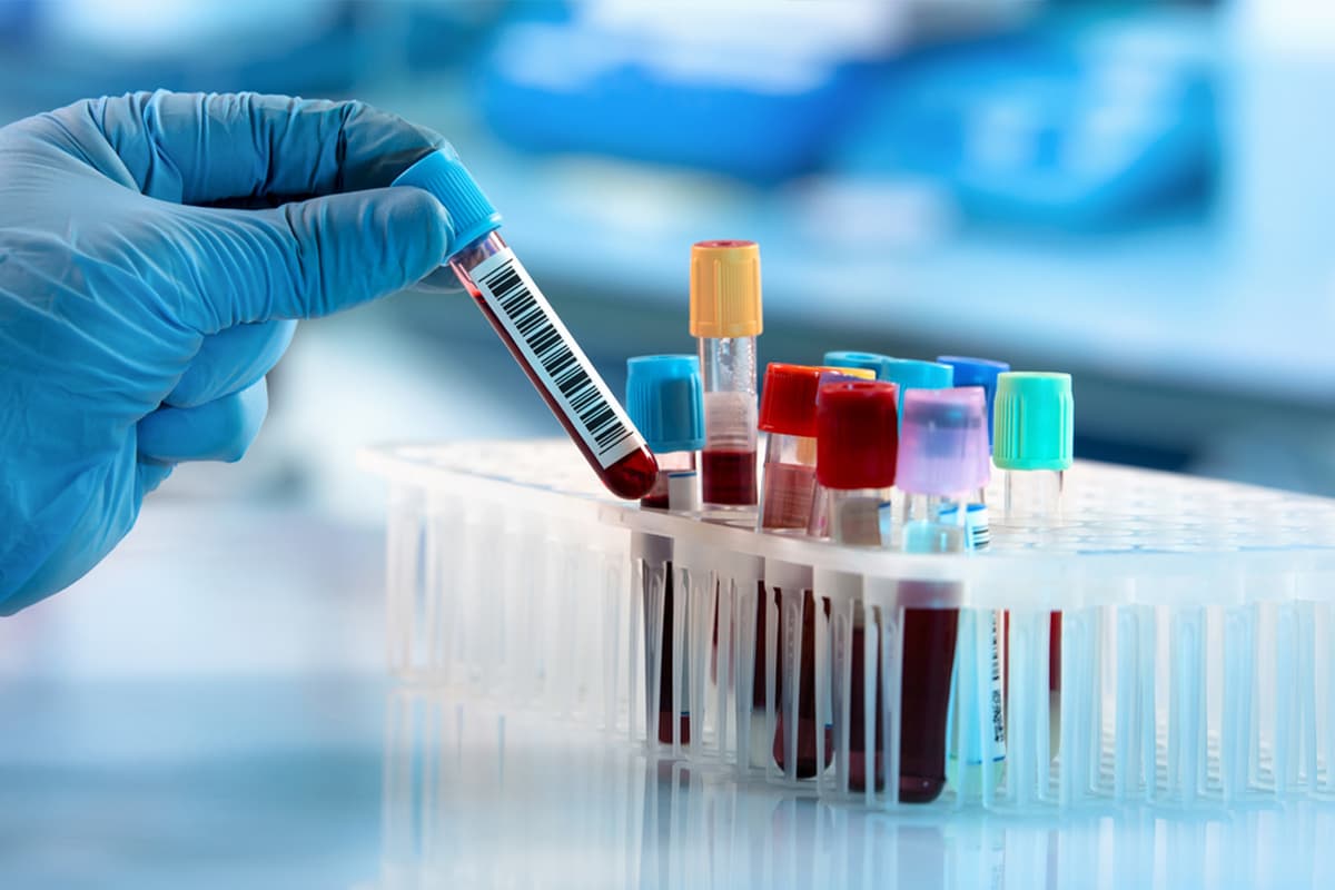 glicemia emoglobina glicata insulina